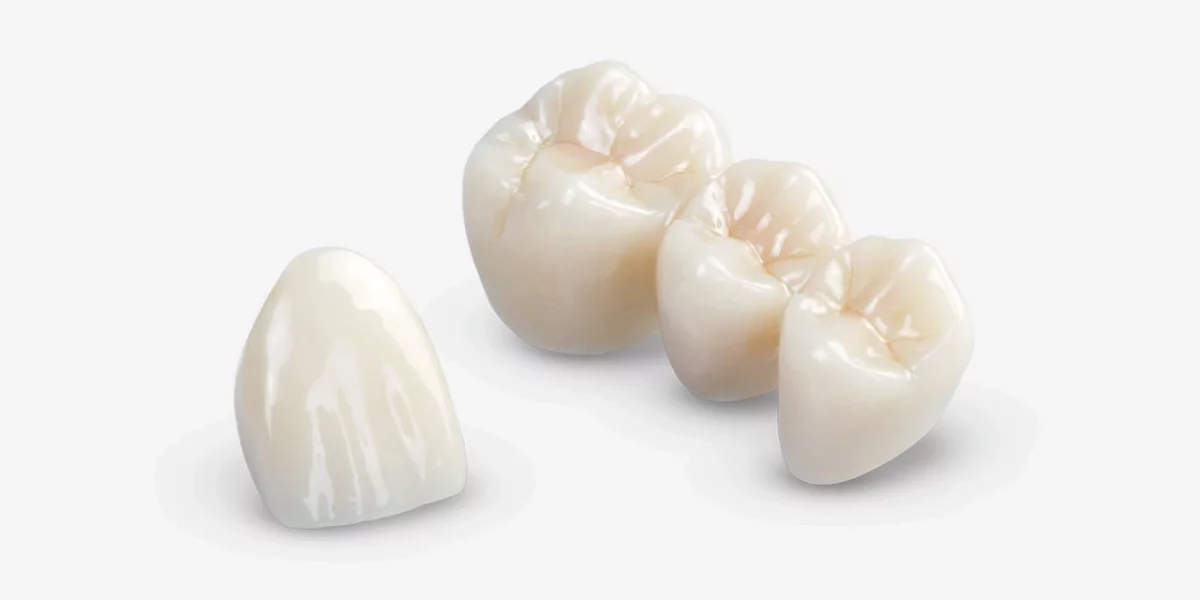 Zirconium vs. Porcelain Crowns: Which One Is Right for You?