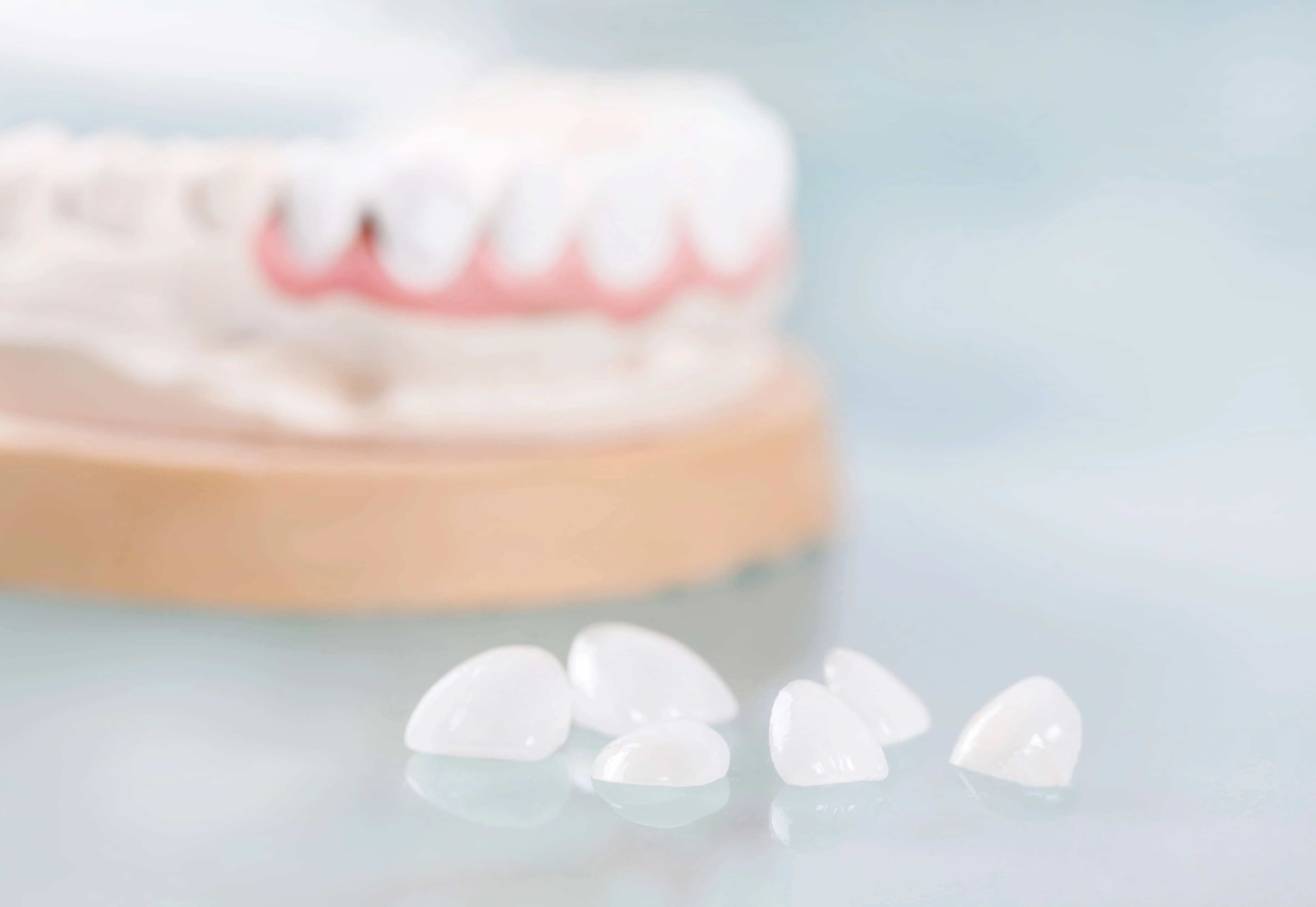 How Long Do Veneers Last and How to Care for Them?