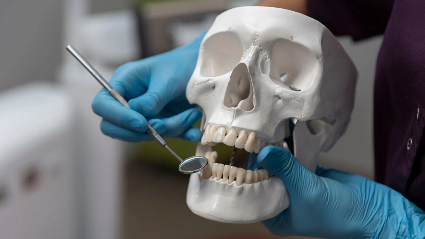 Zygomatic Implants vs. Traditional Implants: Which is Best?