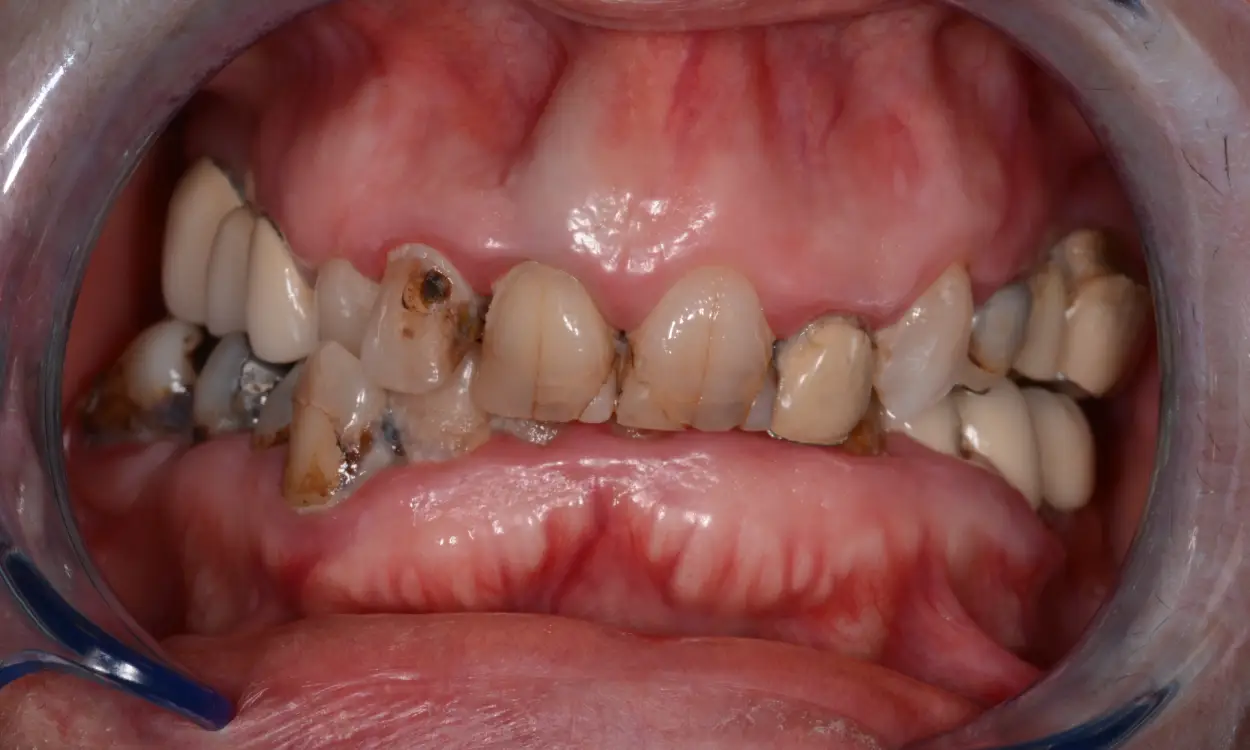 Before